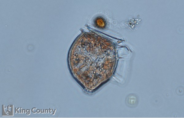 Photo of Dinophysis acuta/Dinophysis norvegica